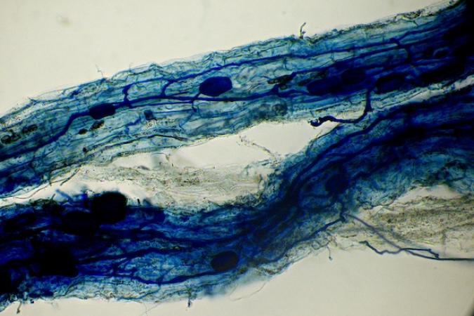 Addenbrookes walk sample